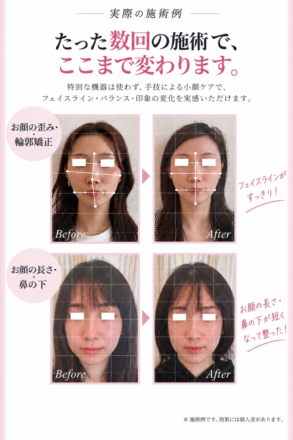 実際の施術例